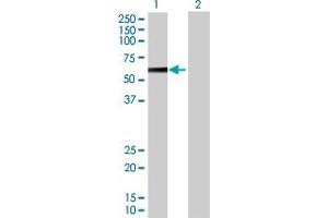 Western Blot analysis of PPP2R5A expression in transfected 293T cell line by PPP2R5A MaxPab polyclonal antibody. (PPP2R5A Antikörper  (AA 1-486))