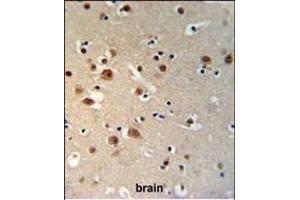 TTBK1 Antibody (N-term) (ABIN1881955 and ABIN2840093) IHC analysis in formalin fixed and paraffin embedded brain tissue followed by peroxidase conjugation of the secondary antibody and DAB staining.