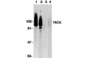 Western Blotting (WB) image for anti-ADAM Metallopeptidase Domain 17 (ADAM17) (C-Term) antibody (ABIN1030720)
