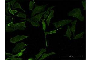 Immunofluorescence of monoclonal antibody to PIM1 on HeLa cell.