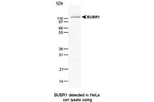 Image no. 1 for anti-Budding Uninhibited By Benzimidazoles 1 Homolog beta (Yeast) (BUB1B) antibody (ABIN363218)