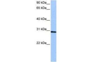 Western Blotting (WB) image for anti-Ankyrin Repeat and SOCS Box-Containing 11 (ASB11) antibody (ABIN2463472) (ASB11 Antikörper)