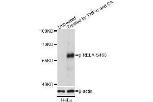 Western blot analysis of extracts of HeLa cells, using Phospho-RELA-S468 antibody (ABIN2988289) at 1/2000 dilution. (NF-kB p65 Antikörper  (pSer468))