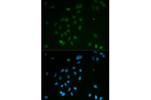 Immunofluorescence analysis of MCF-7 cells using CHEK2 antibody (ABIN5971172). (CHEK2 Antikörper)