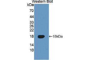 Detection of Recombinant TNFRSF19, Human using Polyclonal Antibody to Tumor Necrosis Factor Receptor Superfamily, Member 19 (TNFRSF19) (TNFRSF19 Antikörper  (AA 35-160))