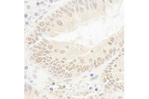 Immunohistochemistry (IHC) image for anti-DOT1-Like, Histone H3 Methyltransferase (S. Cerevisiae) (DOT1L) (AA 1000-1050) antibody (ABIN7448534) (DOT1L Antikörper  (AA 1000-1050))