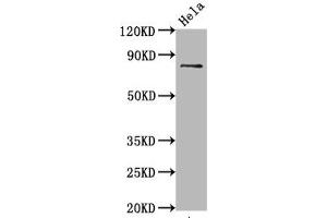 Western Blot Positive WB detected in Hela whole cell lysate All lanes Phospho-MAPT antibody at 0. (Rekombinanter MAPT Antikörper  (pSer396))