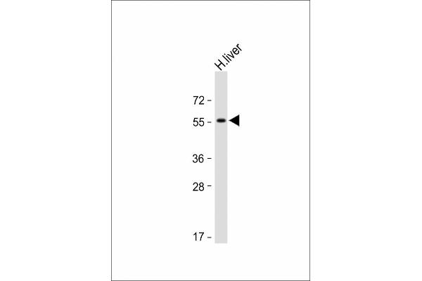 Activin A Receptor Type IB/ALK-4 Antikörper  (N-Term)