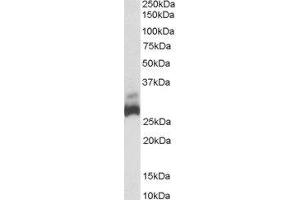 ABIN2559853 (0. (SDHB Antikörper  (C-Term))