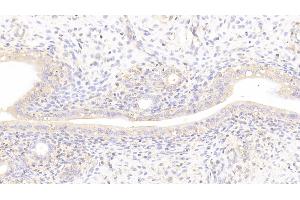 Detection of LAMb2 in Rat Uterus Tissue using Polyclonal Antibody to Laminin Beta 2 (LAMb2) (LAMB2 Antikörper  (AA 939-1129))