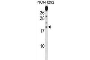 Western Blotting (WB) image for anti-Proline Rich 15 (PRR15) antibody (ABIN2998394) (Proline Rich 15 Antikörper)