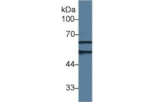 Detection of ACHE in Human Jurkat cell lysate using Polyclonal Antibody to Acetylcholinesterase (ACHE) (Acetylcholinesterase Antikörper  (AA 157-332))