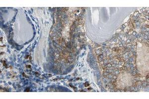 ABIN6276618 at 1/100 staining Human prostate tissue by IHC-P.