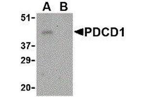 Western Blotting (WB) image for anti-Programmed Cell Death 1 (PDCD1) (Center) antibody (ABIN2479656) (PD-1 Antikörper  (Center))