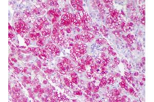 Anti-ACAT1 antibody IHC of human adrenal cortex.