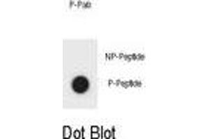 Dot blot analysis of KIT Antibody (Phospho ) Phospho-specific Pab (ABIN1881482 and ABIN2850466) on nitrocellulose membrane. (KIT Antikörper  (pSer959))
