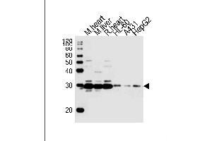 Western blot analysis of lysates from mouse heart, mouse liver, rat heart tissue, HL-60, A431, HepG2 cell line (from left to right), using (DANRE) sdhb Antibody Azb18722a. (SDHB Antikörper  (AA 147-182))