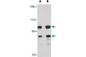 Western blot analysis of DLGAP1 in rat brain tissue lysate with DLGAP1 polyclonal antibody  at (A) 0.