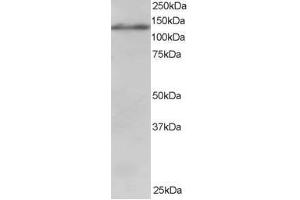 Image no. 1 for anti-Ubiquitin Specific Peptidase 11 (USP11) (AA 951-963) antibody (ABIN297833)