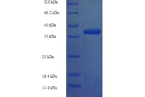 SDS-PAGE (SDS) image for Collagen, Type IV, alpha 1 (COL4A1) (AA 1445-1669) protein (His-SUMO Tag) (ABIN5709309)
