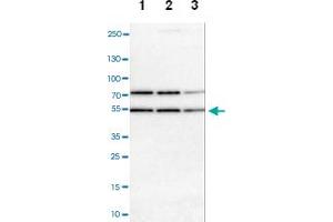 Western blot analysis of Lane 1: NIH-3T3 cell lysate (Mouse embryonic fibroblast cells), Lane 2: NBT-II cell lysate (Rat Wistar bladder tumour cells), Lane 3: PC12 cell lysate (Pheochromocytoma of rat adrenal medulla) with RBM22 polyclonal antibody at 1:100-1:500 dilution. (RBM22 Antikörper)