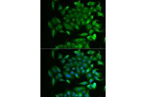 Immunofluorescence analysis of MCF-7 cells using RBP2 antibody (ABIN5974059). (RBP2 Antikörper)