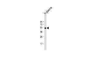 Anti-IGHG1 Antibody (Center) at 1:2000 dilution + human plasma lysate Lysates/proteins at 20 μg per lane. (IGHG1 Antikörper  (AA 154-180))