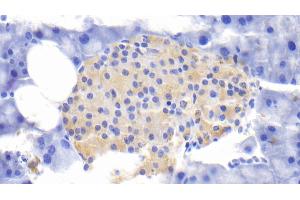 Detection of IL1RA in Mouse Pancreas Tissue using Polyclonal Antibody to Interleukin 1 Receptor Antagonist (IL1RA) (IL1RN Antikörper  (AA 27-178))