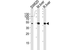 Western Blotting (WB) image for anti-Ornithine Carbamoyltransferase (OTC) antibody (ABIN3002885) (OTC Antikörper)