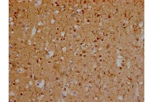 IHC image of ABIN7127835 diluted at 1:100 and staining in paraffin-embedded human brain tissue performed on a Leica BondTM system. (Rekombinanter MAPT Antikörper)
