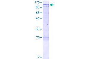 GRIPAP1 Protein (AA 1-841) (GST tag)