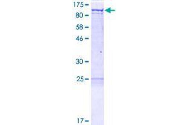 GRIPAP1 Protein (AA 1-841) (GST tag)