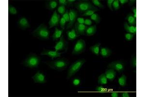 Immunofluorescence of monoclonal antibody to PDCD6 on HeLa cell. (PDCD6 Antikörper  (AA 92-191))