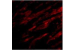 Immunofluorescence of PDL-1 in Human Heart cells with PDL-1at 20 ug/ml. (PD-L1 Antikörper  (Center))