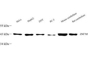 Western blot analysis of ZNF785 (ABIN7076274) at dilution of 1: 500 (ZNF785 Antikörper)