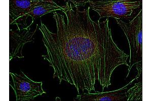 Immunocytochemistry analysis of Fyn in murine transformed fibroblasts using anti-Fyn (FYN-01, red). (FYN Antikörper  (AA 7-176))