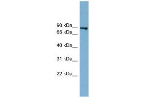 WB Suggested Anti-FASTKD2 Antibody Titration: 0. (FASTKD2 Antikörper  (Middle Region))