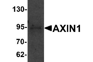 Western Blotting (WB) image for anti-Axin 1 (AXIN1) (C-Term) antibody (ABIN1030273) (Axin Antikörper  (C-Term))
