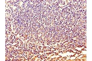 Immunohistochemistry of paraffin-embedded human tonsil tissue using ABIN7146099 at dilution of 1:100 (CXCR2 Antikörper  (AA 1-40))