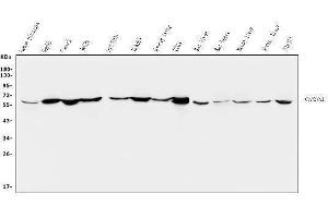 Western blot analysis of CYP27A1 using anti-CYP27A1 antibody (ABIN7602336).