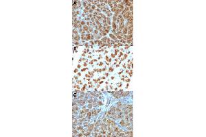 Immunohistochemical staining (Formalin-fixed paraffin-embedded sections) of human pancreas (A), rat pancreas (B) and mouse pancreas (C) with ELA3B monoclonal antibody, clone CELA3B/1257 . (Elastase 3B Antikörper  (AA 82-238))