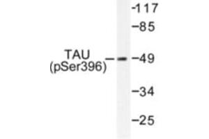 Image no. 1 for anti-Microtubule-Associated Protein tau (MAPT) (pSer396) antibody (ABIN318142) (MAPT Antikörper  (pSer396))