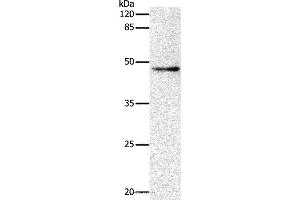 Western blot analysis of Hela cell, using DRD1 Polyclonal Antibody at dilution of 1:500 (Dopamine Receptor d1 Antikörper)