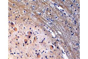 Tryptophan Hydroxylase 2 Antikörper  (Internal Region)