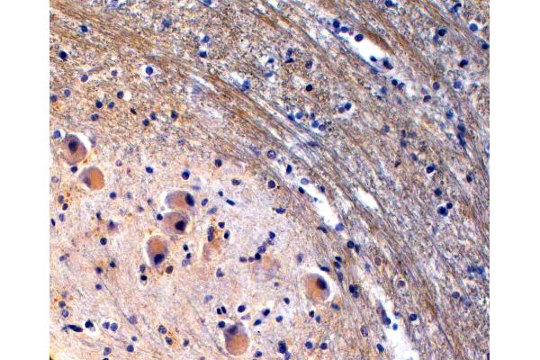 Tryptophan Hydroxylase 2 Antikörper  (Internal Region)