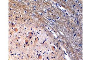 (ABIN185533) (2 μg/mL) staining of paraffin embedded Human Brain Stem. (Tryptophan Hydroxylase 2 Antikörper  (Internal Region))
