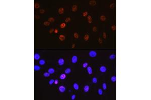 Immunofluorescence analysis of NIH-3T3 cells using Cyclin H Rabbit mAb (ABIN7266569) at dilution of 1:100 (40x lens). (Cyclin H Antikörper)