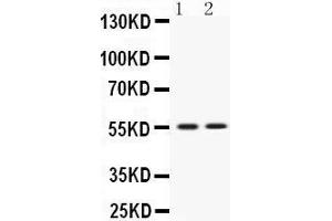 Western blot analysis of VRK1 expression in rat thymus extract (lane 1) and JURKAT whole cell lysates (lane 2).