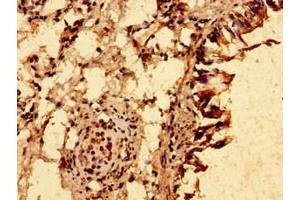 Immunohistochemistry of paraffin-embedded human lung tissue using ABIN7151248 at dilution of 1:100 (TRIM21 Antikörper  (AA 1-475))