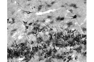 Adult rat dentate gyrus immunohistochemistry.